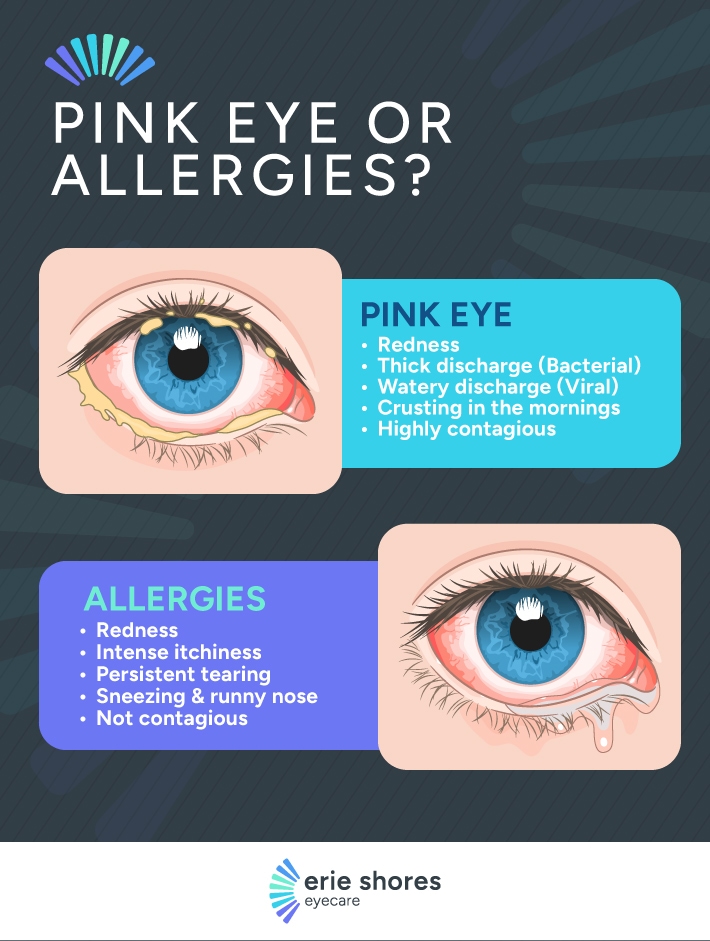An infographic titled "Pink Eye or Allergies?" from Erie Shores Eyecare compares symptoms of pink eye and eye allergies. It features two illustrated eyes showing differences in appearance. The pink eye section lists: redness, thick discharge (bacterial), watery discharge (viral), crusting in the mornings, and highly contagious. The allergies section lists: redness, intense itchiness, persistent tearing, sneezing & runny nose, and not contagious. Each condition is shown with corresponding visual symptoms.
