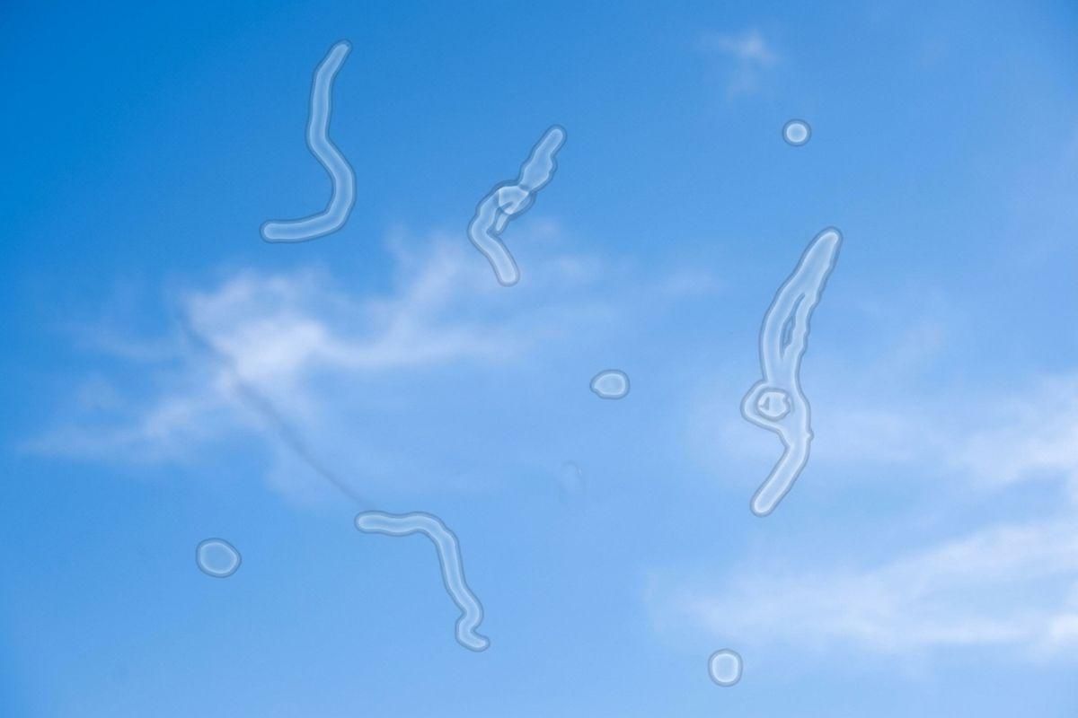 Blue sky with thin white clouds overlaid with translucent squiggly lines and dots simulating the appearance of floaters in vision.